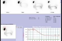 Gallbladder EF WS.jpg