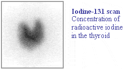 radionuclide