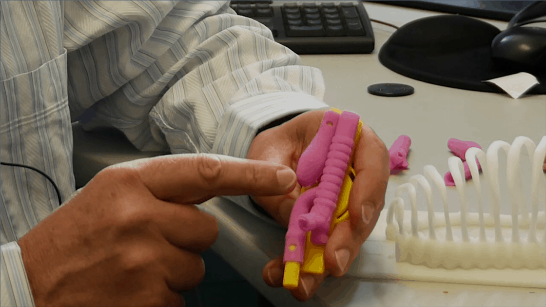 Surgeon Spencer Beasley holding a 3D printed model of an infant's throat with oesophageal atresia.